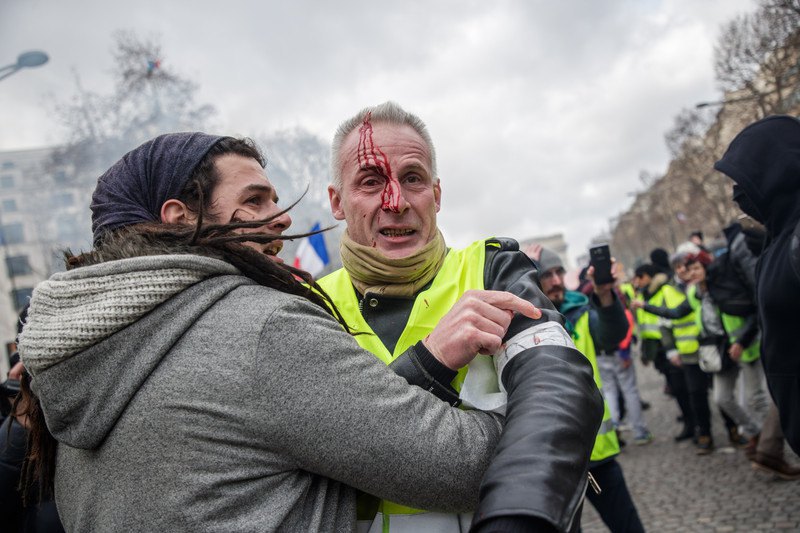 В Париже фотографу, снимавшему акцию "желтых жилетов", взрывом гранаты отвлекло кисть