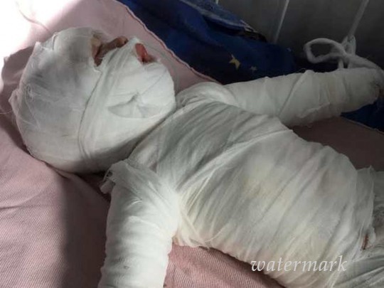 Под Одессой кровная мать "сварила" 11-месячного малыша: детали жуткого инцидента(фото)