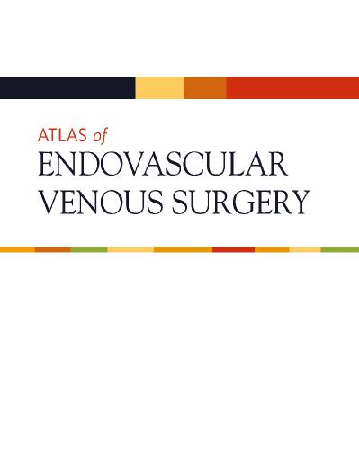 Atlas of Endovascular Venous Surgery-Elsevier (2018)